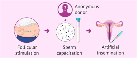 impregnation litrotica|insemination .